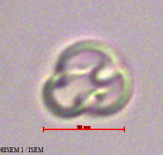ISEM 1/Weinmannia_trichosperma_28579/Weinmannia_trichosperma_28579_0002(copy).jpg